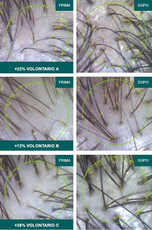 Gli effetti benefici di Krestina sui capelli