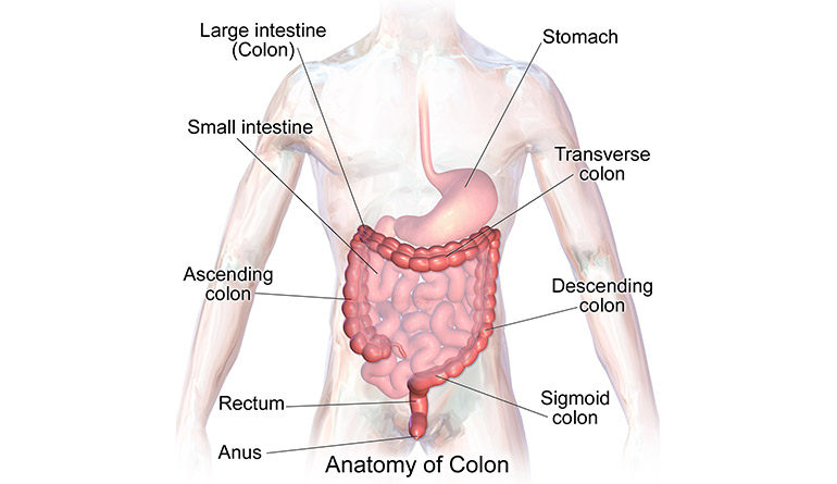 colon colite ulcerosa