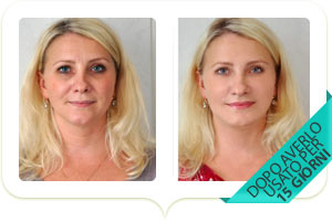 Risultati antiage di Colla Mask